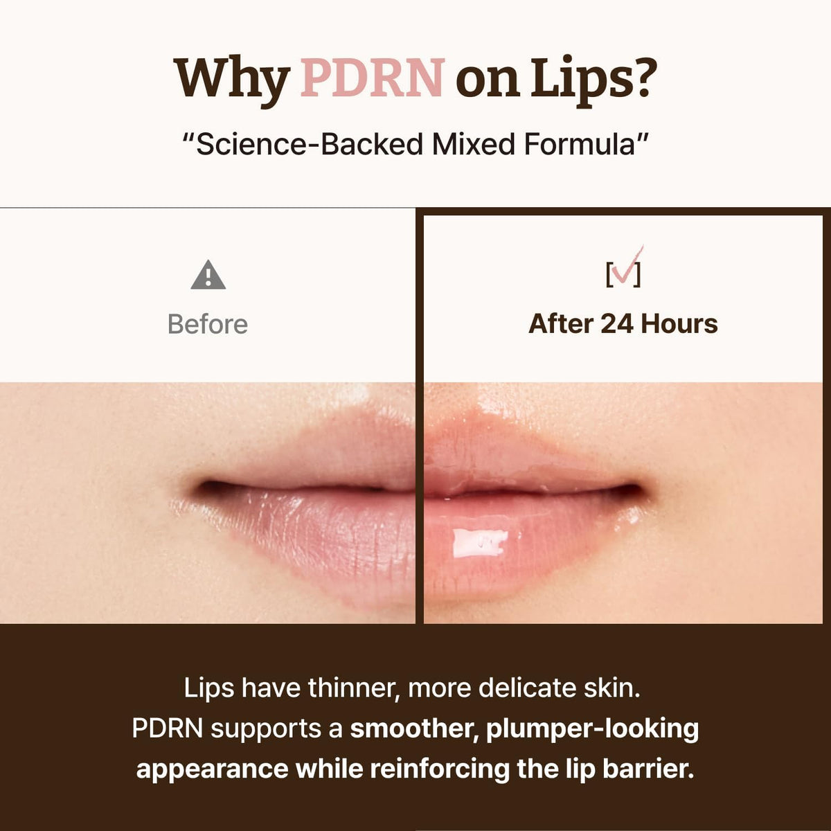 DR.REJU-ALL Advanced PDRN Rejuvenating Lip Serum 10ml