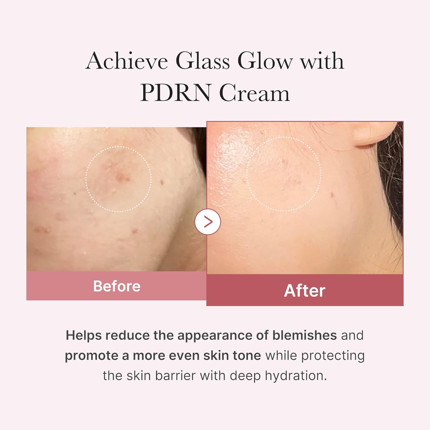 MEDICUBE PDRN Pink Hyaluronic Moisturizing Cream 50ml
