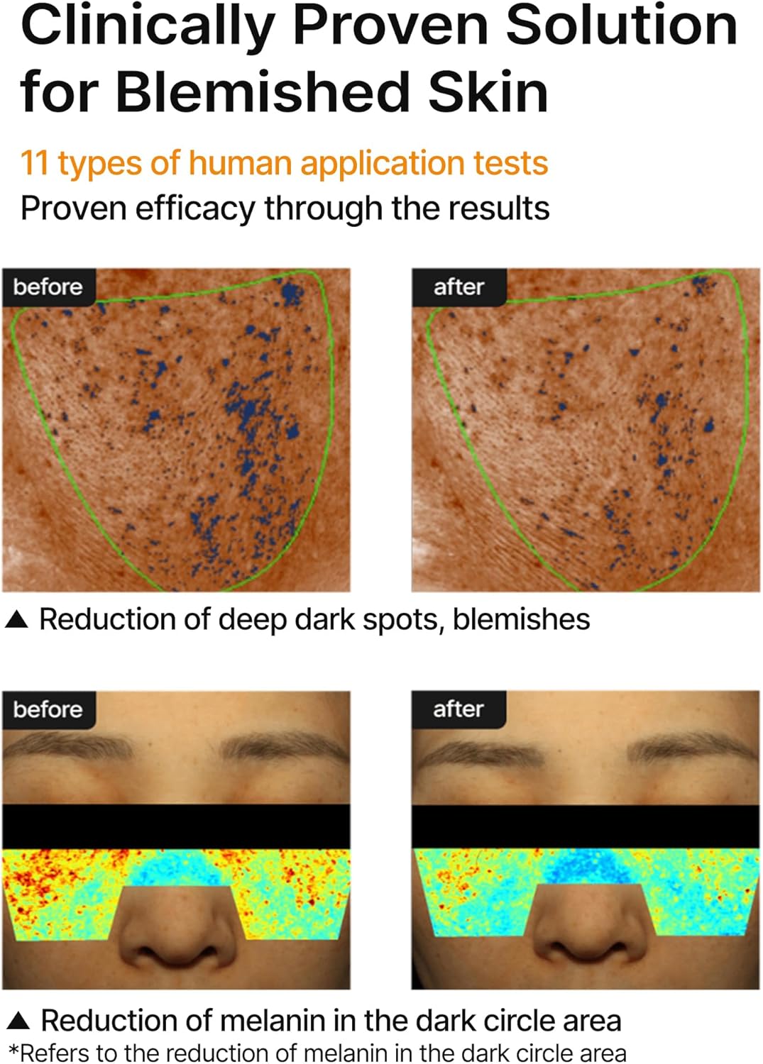 CELIMAX Pore + Dark Spot Brightening Cream 35ml