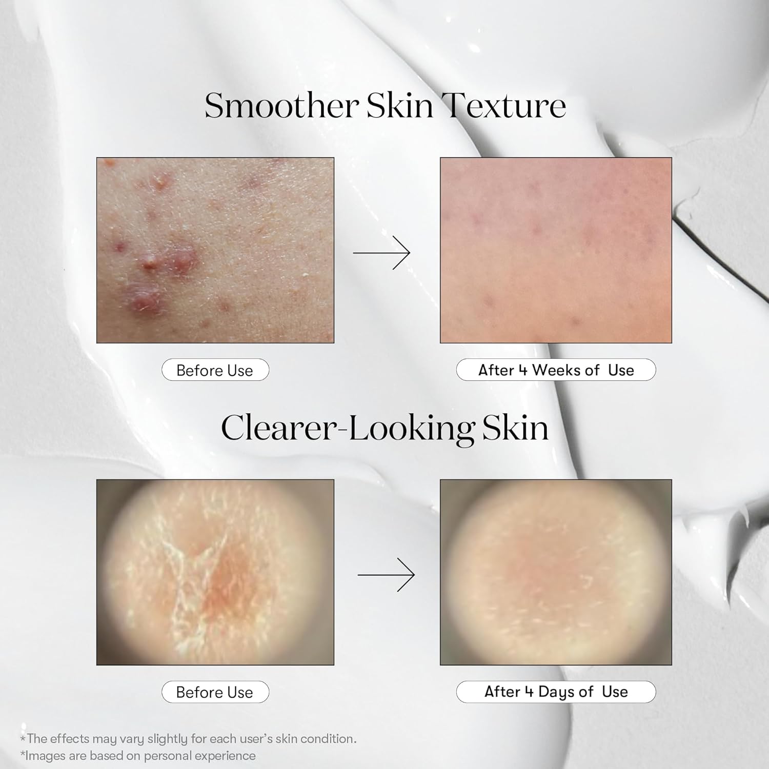 VT COSMETICS Reedle Shot 100 50ml