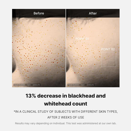 MEDICUBE Zero Pore One Day Serum 50ml