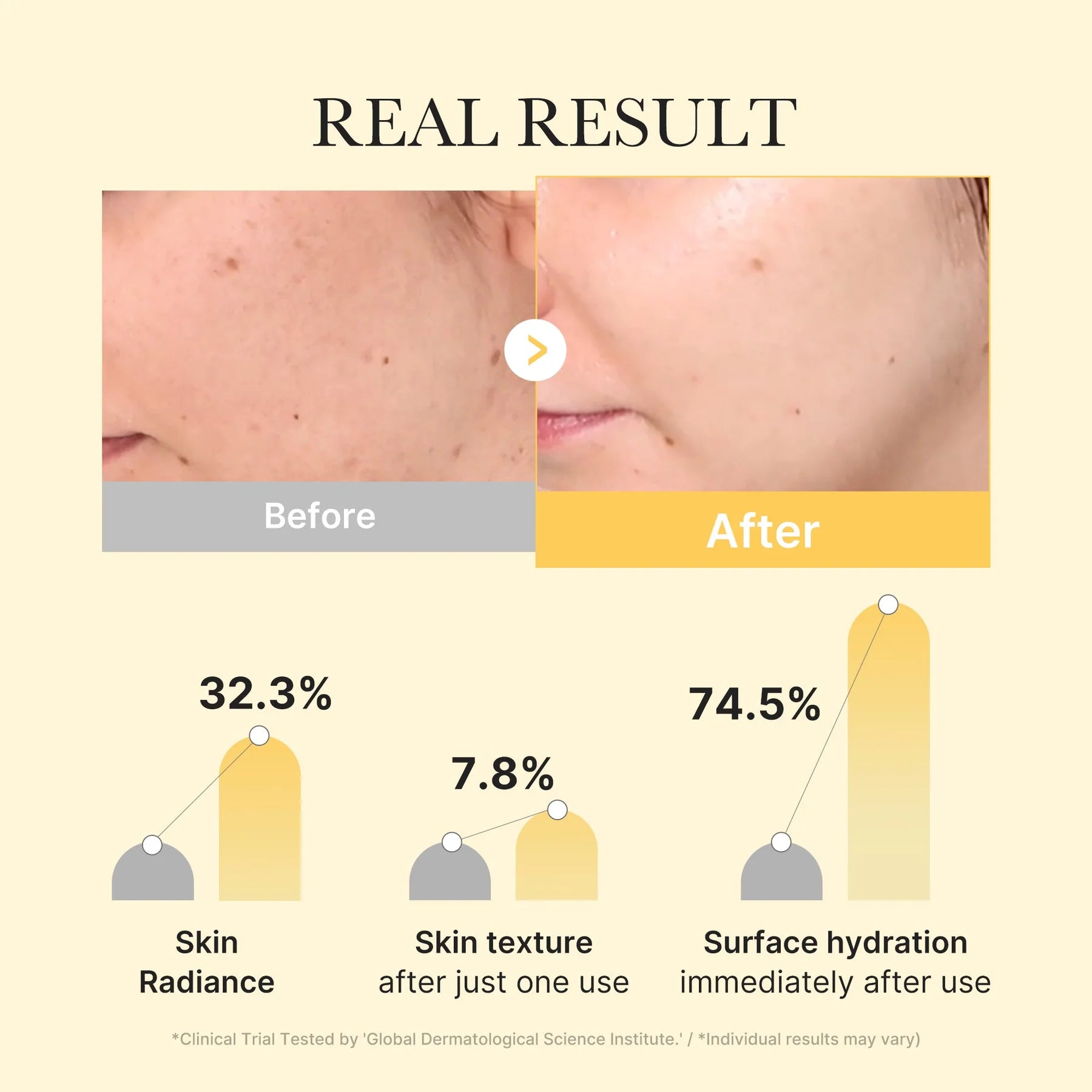 MEDICUBE Kojic Acid Turmeric Brightening Gel Mask (4ea)