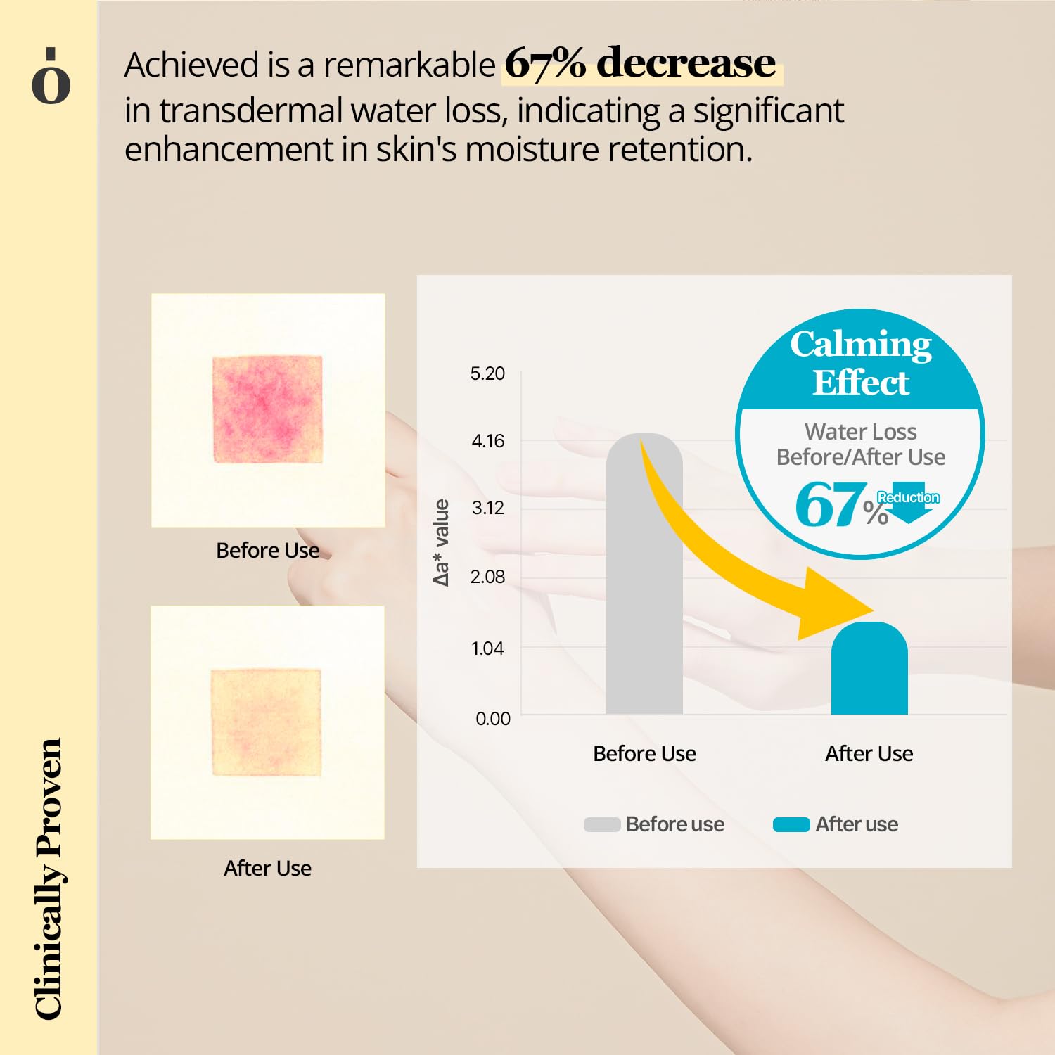 ONGREDIENTS Skin Barrier Calming Lotion 80ml