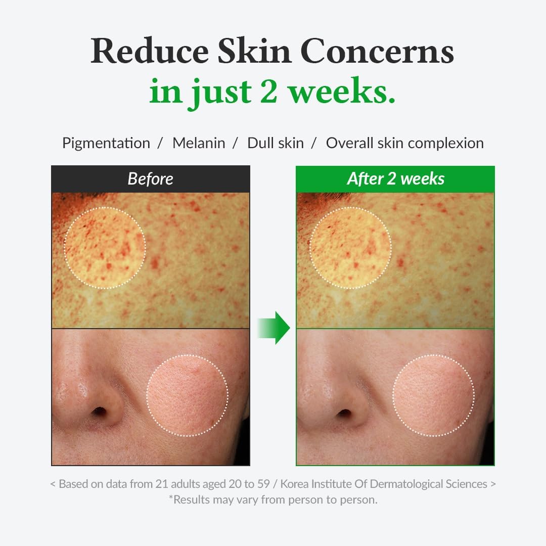 DR.ALTHEA Gentle Vitamin C Serum 30ml