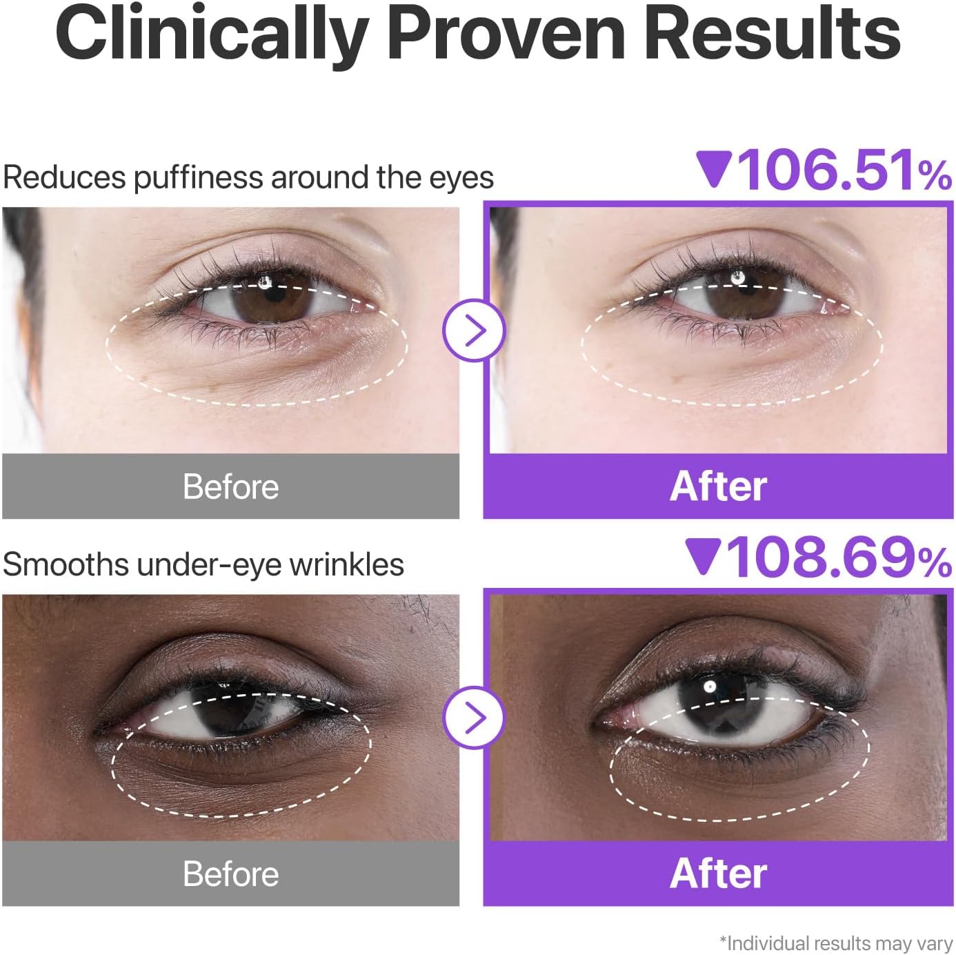 NUMBUZIN No.9 NAD Collagen Under Eye Patches (5ea)
