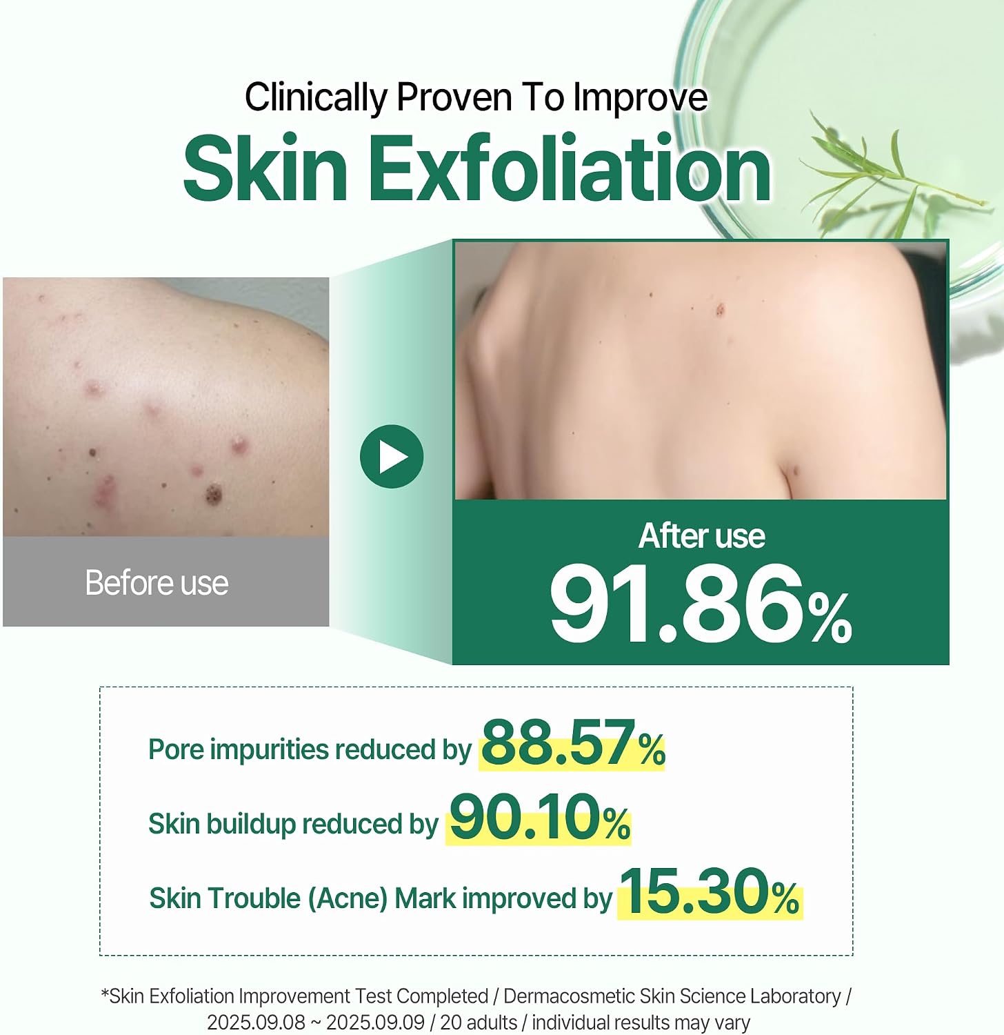 SOME BY MI AHA.BHA.PHA 30 Days Miracle clear body cleanser 400g