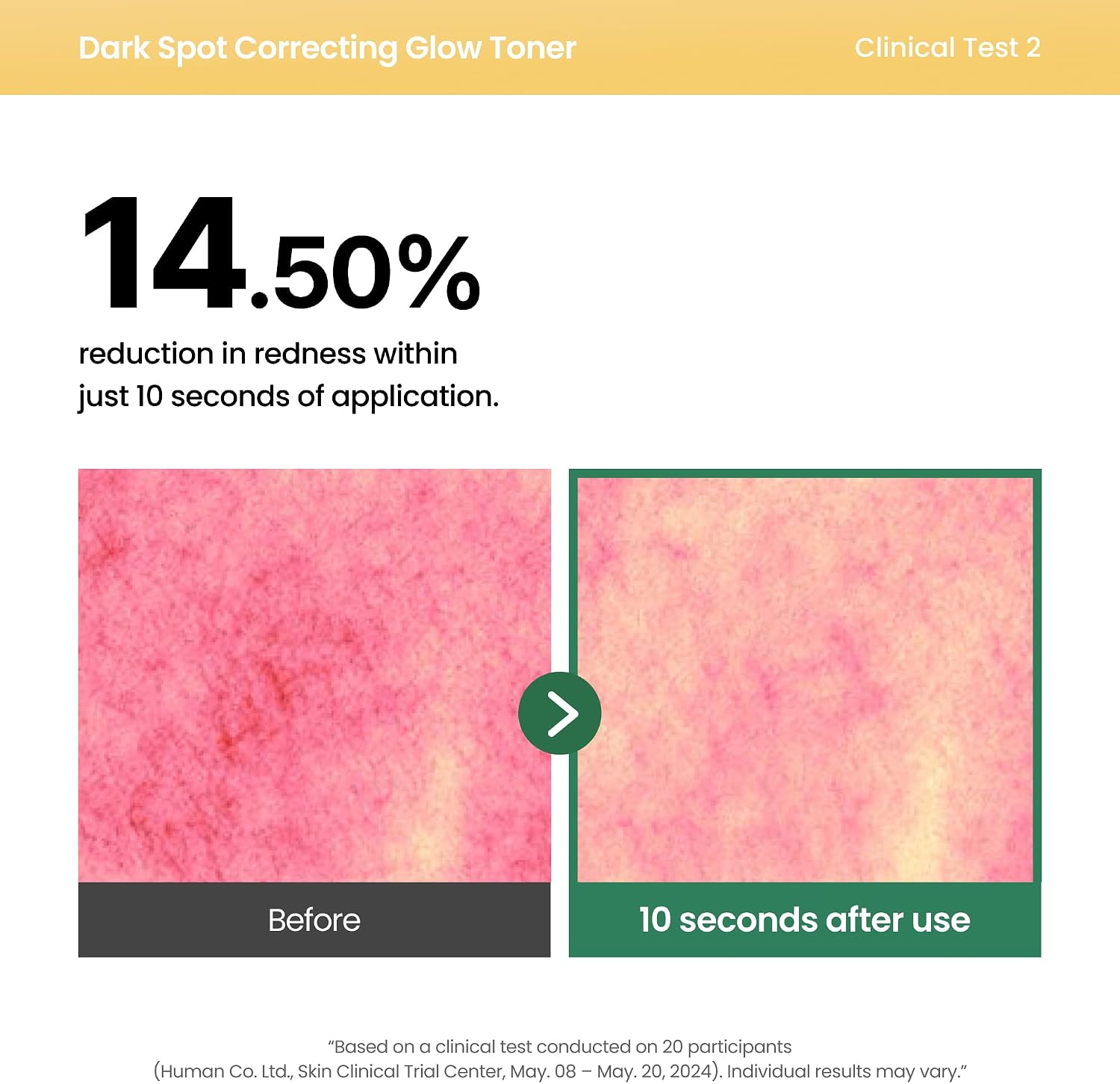AXIS-Y Dark Spot Correcting Glow Toner 125ml
