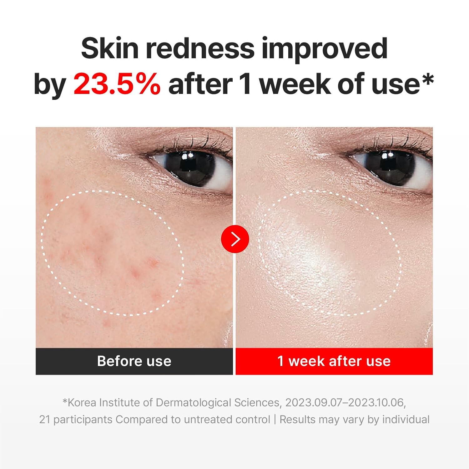CENTELLIAN24 Madeca Cream Time Reverse (Season7) 50ml – Moida K-Beauty