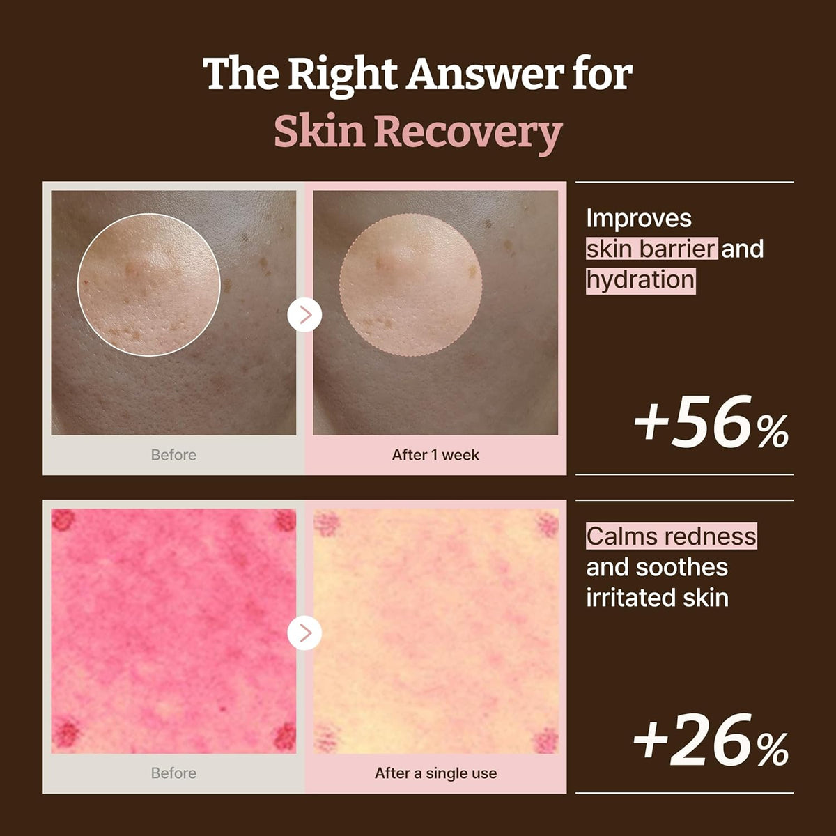 DR.REJU-ALL Advanced PDRN Rejuvenating Cream Max 20ml