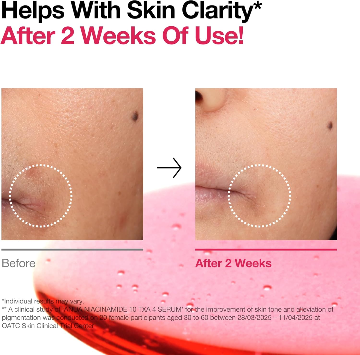 ANUA Niacinamide 10% + TXA 4% Serum 30ml